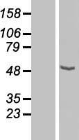 CPN1 Human Over-expression Lysates NM_001308