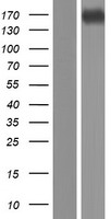 CPS1 Human Over-expression Lysates NM_001875
