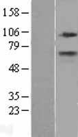 CPT1A Human Over-expression Lysates NM_001031847