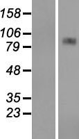 CPT1A Human Over-expression Lysates NM_001876
