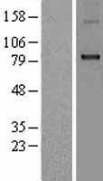CPT1B Human Over-expression Lysates NM_004377