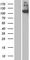 CD21 (CR2) Human Over-expression Lysates NM_001877