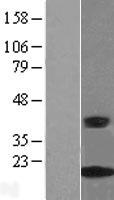 CRABP2 Human Over-expression Lysates NM_001878