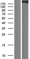 KAT3A / CBP (CREBBP) Human Over-expression Lysates NM_004380