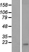 CREM Human Over-expression Lysates NM_182720