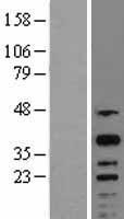 CREM Human Over-expression Lysates NM_182771