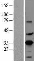ls001390 crem human over expression lysates nm 183013 wb testing 4