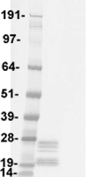 Corticotropin Releasing Factor (CRH) Human Over-expression Lysates NM_000756