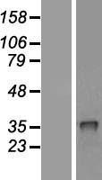 CRHBP Human Over-expression Lysates NM_001882