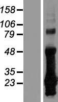 CRIP2 Human Over-expression Lysates NM_001312