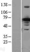 CRMP1 Human Over-expression Lysates NM_001313
