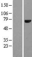 Cryptochrome I (CRY1) Human Over-expression Lysates NM_004075