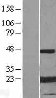 Alpha B Crystallin (CRYAB) Human Over-expression Lysates NM_001885