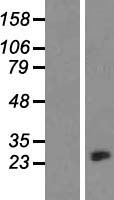 beta Crystallin A3 (CRYBA1) Human Over-expression Lysates NM_005208