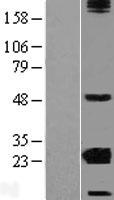 CRYBA2 Human Over-expression Lysates NM_005209