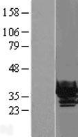 beta B1 Crystallin (CRYBB1) Human Over-expression Lysates NM_001887