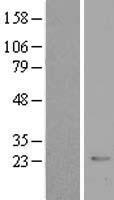 ls001415 crybb2 human over expression lysates nm 000496 wb testing 1