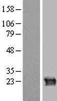 ls001419 crygb human over expression lysates nm 005210 wb testing 1