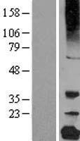 ls001420 gamma c crystallin crygc human over expression lysates nm 020989 wb testing 1