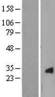 Beta crystallin S (CRYGS) Human Over-expression Lysates NM_017541