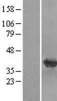 mu Crystallin (CRYM) Human Over-expression Lysates NM_001888