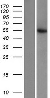 Citrate synthetase (CS) Human Over-expression Lysates NM_004077
