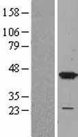 p38 (MAPK14) Human Over-expression Lysates NM_001315