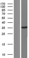 p38 (MAPK14) Human Over-expression Lysates NM_139013