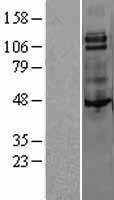 MCSF Receptor (CSF1R) Human Over-expression Lysates NM_005211