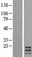 GM CSF (CSF2) Human Over-expression Lysates NM_000758