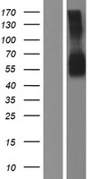 GM CSF Receptor alpha (CSF2RA) Human Over-expression Lysates NM_001161531