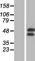 GM CSF Receptor alpha (CSF2RA) Human Over-expression Lysates NM_006140
