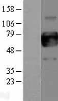 ls001438 gm csf receptor alpha csf2ra human over expression lysates nm 172245 wb testing 2