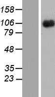 ls001439 il3rb csf2rb human over expression lysates nm 000395 wb testing 1