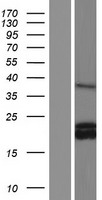 G CSF (CSF3) Human Over-expression Lysates NM_001178147