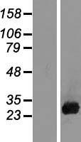Placental lactogen (CSH1) Human Over-expression Lysates NM_001317