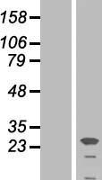 Placental lactogen (CSH1) Human Over-expression Lysates NM_022640