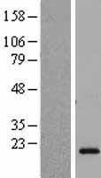 Placental lactogen (CSH2) Human Over-expression Lysates NM_022644