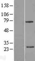 beta Casein (CSN2) Human Over-expression Lysates NM_001891