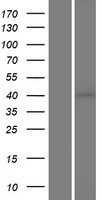 Casein Kinase 1 alpha (CSNK1A1) Human Over-expression Lysates NM_001025105