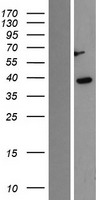 Casein Kinase 1 alpha (CSNK1A1) Human Over-expression Lysates NM_001892