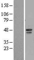 Casein Kinase 1 delta (CSNK1D) Human Over-expression Lysates NM_001893