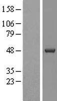 Casein Kinase 1 delta (CSNK1D) Human Over-expression Lysates NM_139062