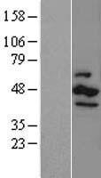 CK1 epsilon (CSNK1E) Human Over-expression Lysates NM_001894