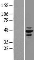 CK1 epsilon (CSNK1E) Human Over-expression Lysates NM_152221
