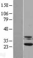 Casein Kinase 2 beta (CSNK2B) Human Over-expression Lysates NM_001320