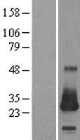 CSRP2 Human Over-expression Lysates NM_001321