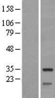 Mitochondrial dicarboxylate carrier (SLC25A10) Human Over-expression Lysates NM_012140