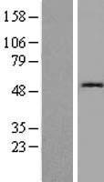 Cystatin SN (CST1) Human Over-expression Lysates NM_001898