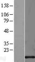 Cystatin C (CST3) Human Over-expression Lysates NM_000099